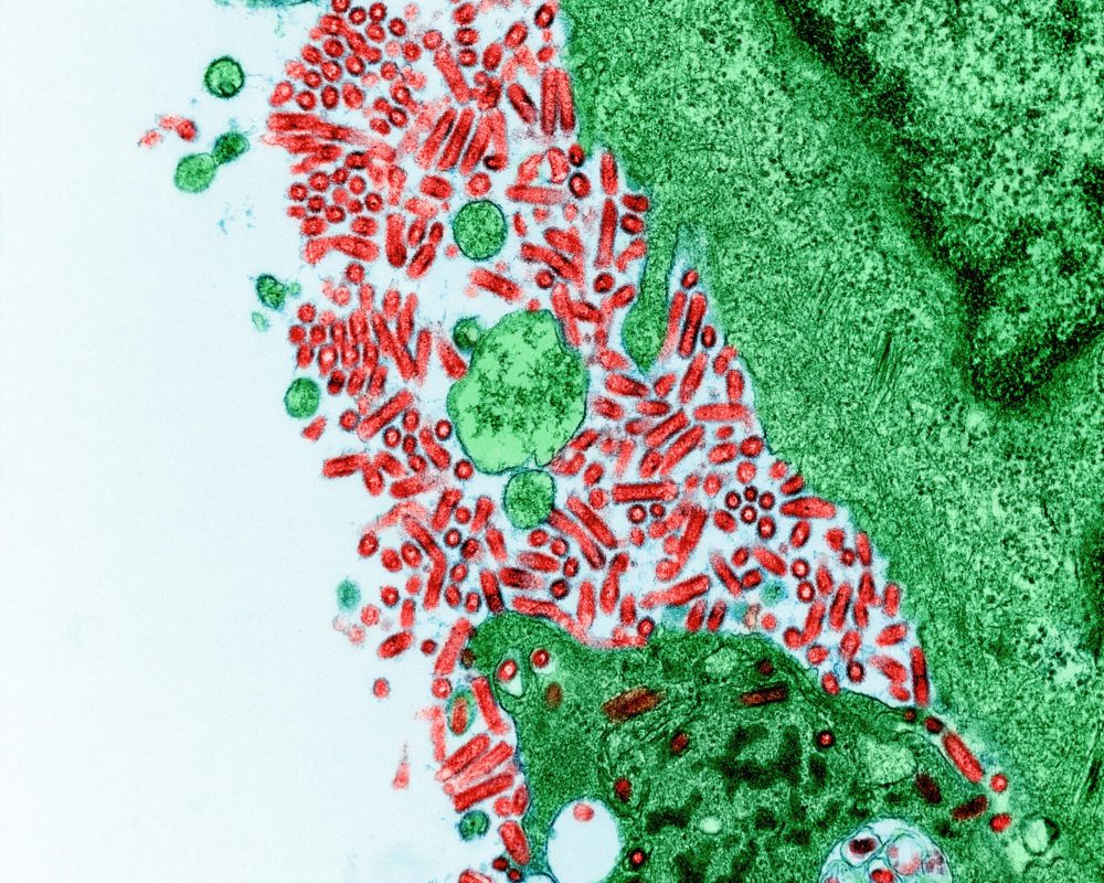 virus bakterium kep