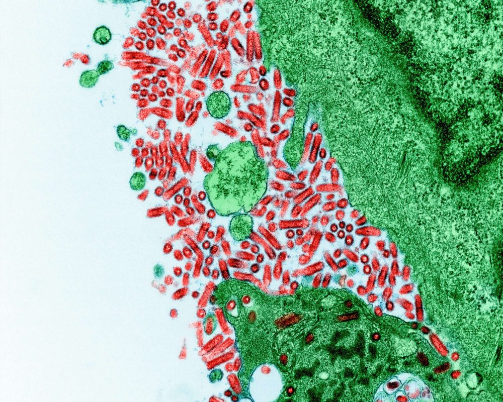virus bakterium kep